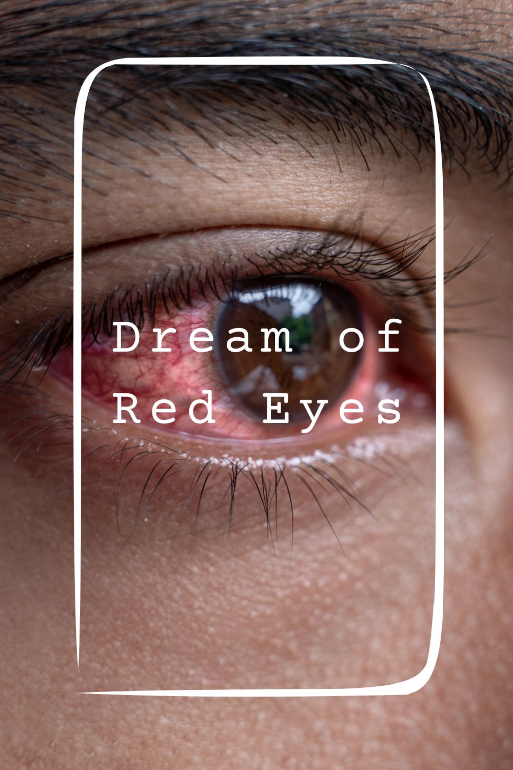 15 Dream of Red Eyes Meanings1