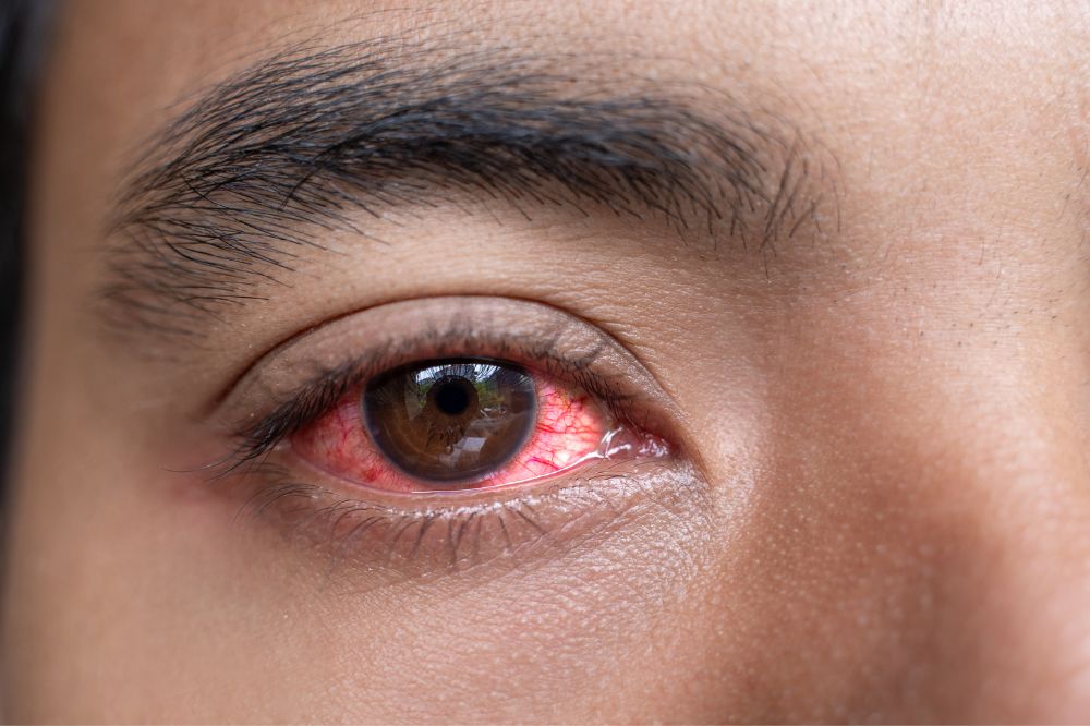 15 Dream of Red Eyes Meanings3