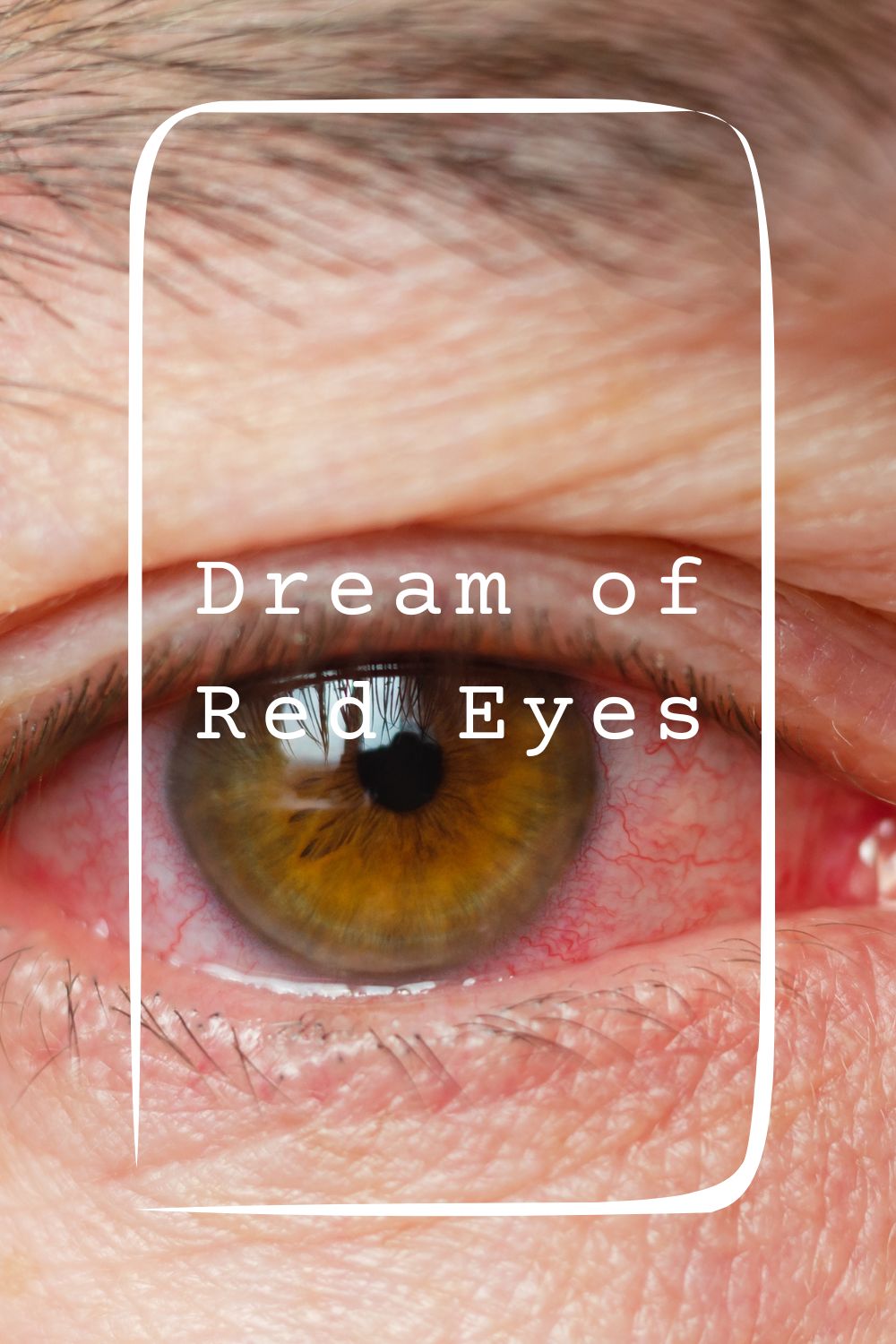 15 Dream of Red Eyes Meanings4