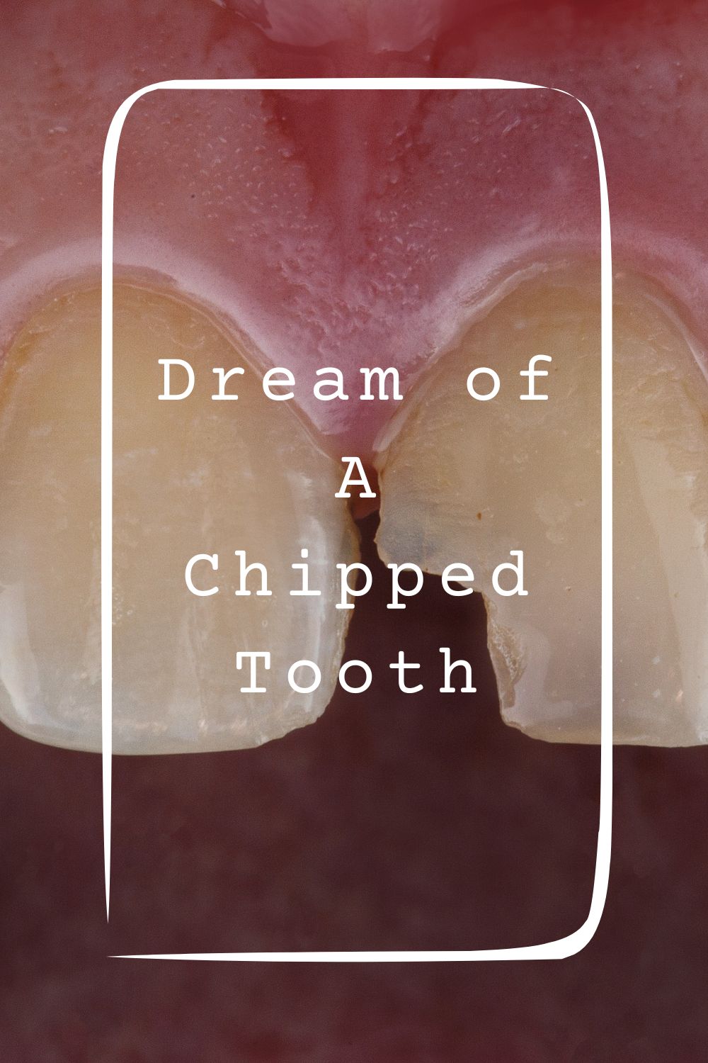 8 Dream of A Chipped Tooth Meanings1