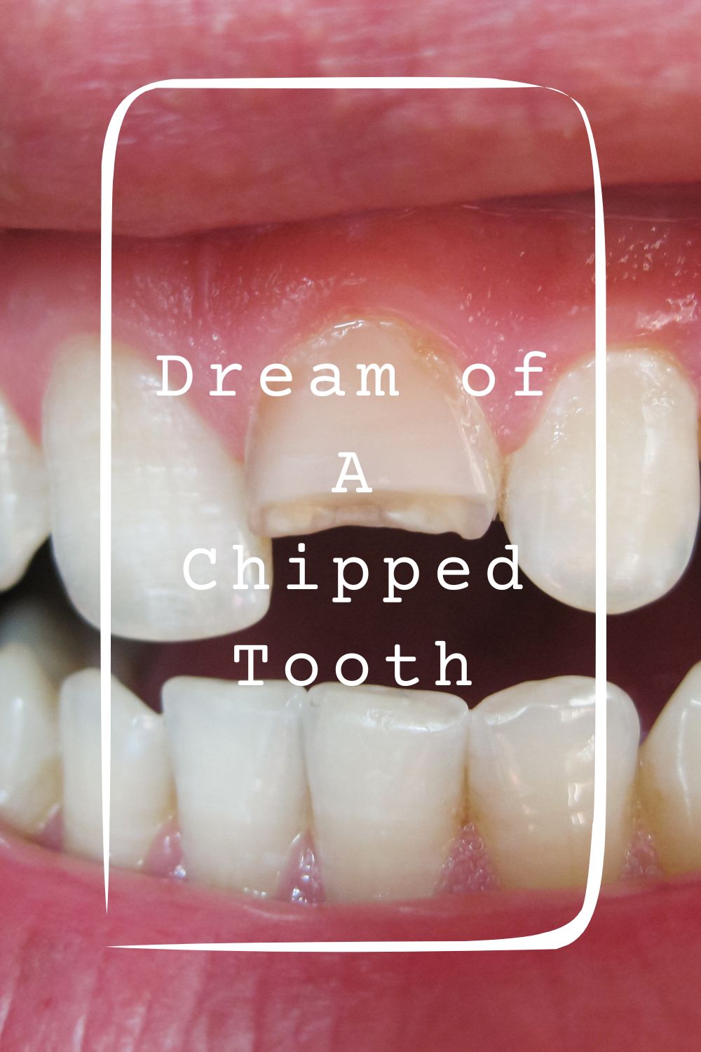 8 Dream of A Chipped Tooth Meanings4