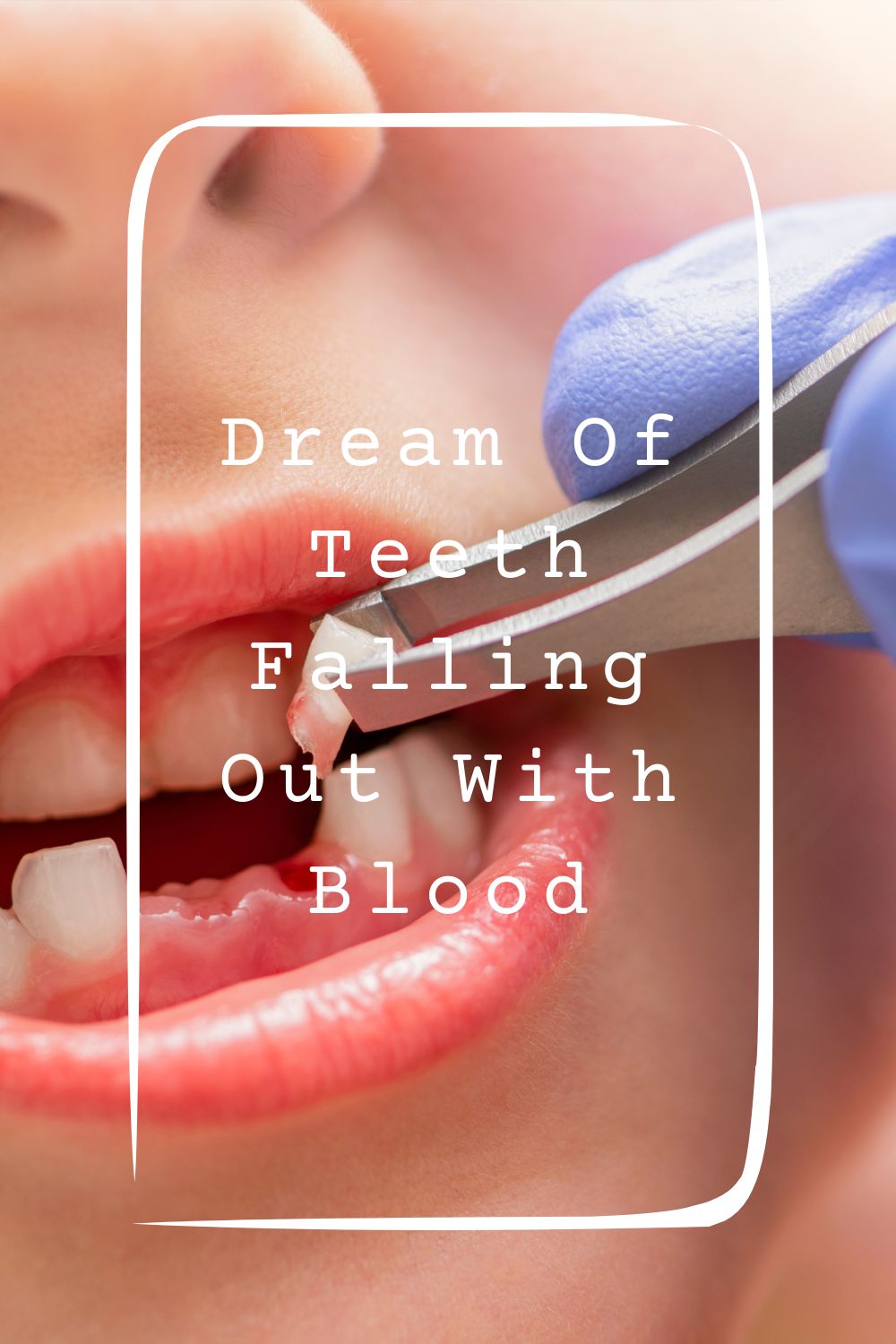 Dream Of Teeth Falling Out With Blood Meanings 2