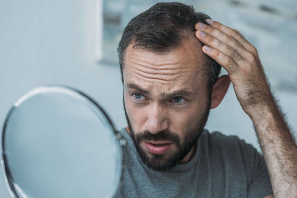 12 Dream of Hair Loss Meanings2
