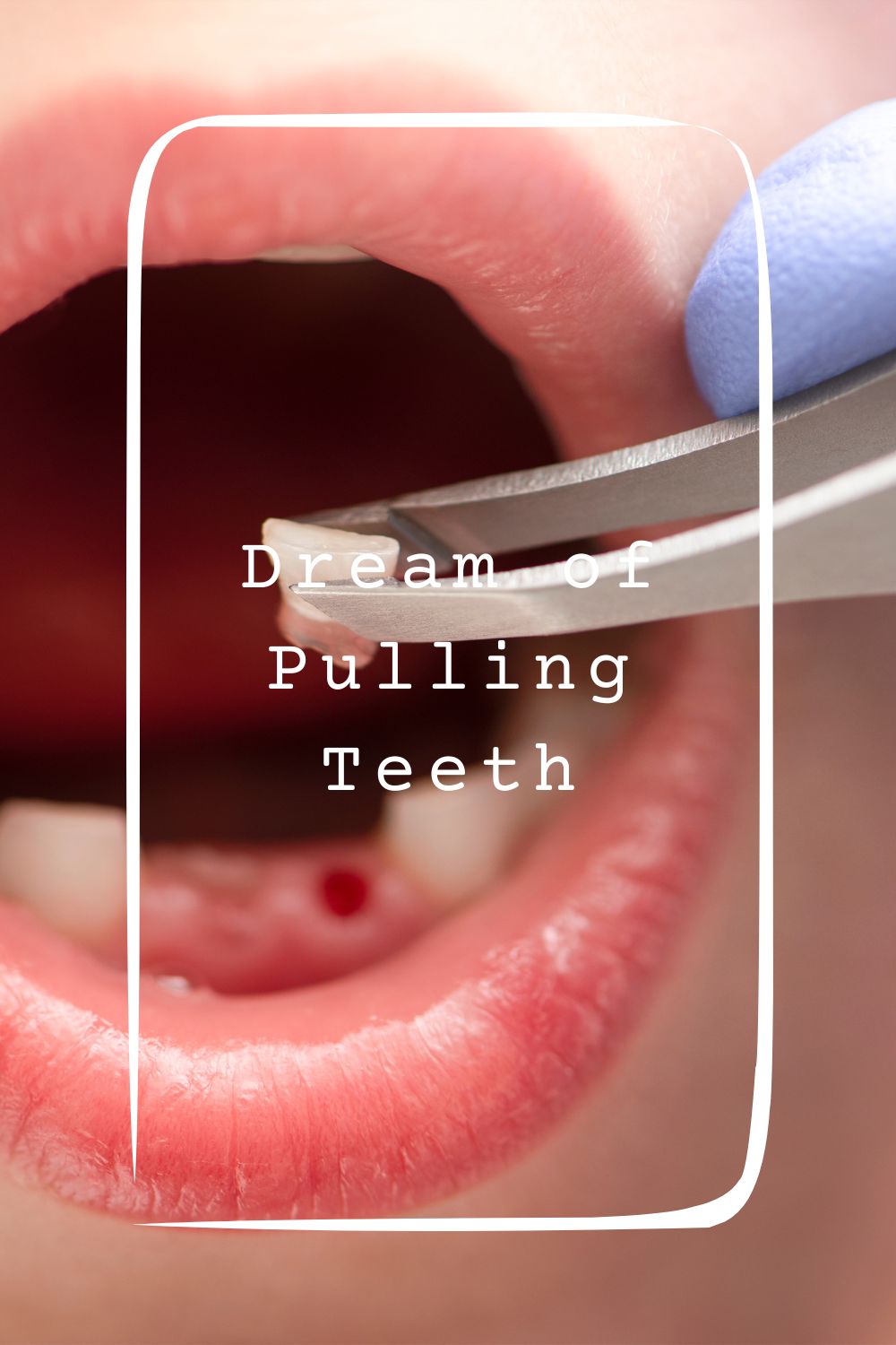 Dream of Pulling Teeth4